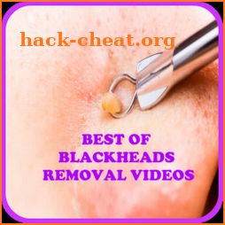 Blackheads Removal Videos icon