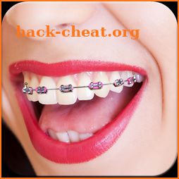 Braces Camera icon