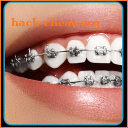 Braces Photo Editor - Braces Filter Colored icon