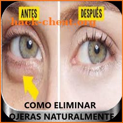 Como Eliminar Ojeras icon