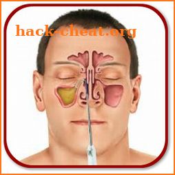 How to Treat Chronic Sinusitis icon