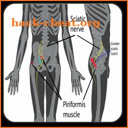 Piriformis syndrome icon