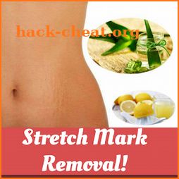 STRETCH MARK REMOVAL icon