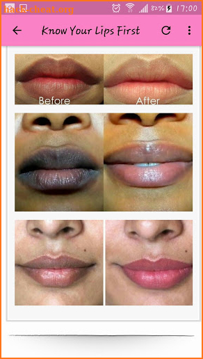 13 Home Remedies To Get Soft Pink Lips Naturally screenshot