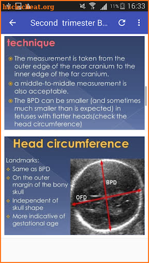 2nd & 3rd trimester OB/GY Ultrasound screenshot