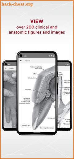 5-Minute Sports Medicine Consult screenshot