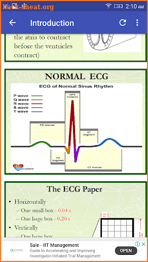 A to Z ECG Interpretation screenshot