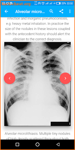 A-Z Chest X-Ray Interpretation screenshot