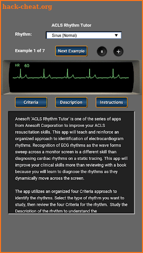 ACLS Rhythm Tutor screenshot