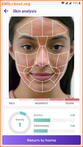 Acne Intelligence screenshot