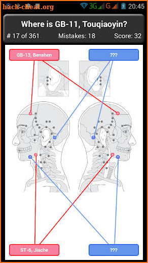 Acupuncture Points Body Quiz screenshot