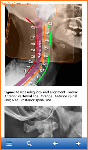 Advanced Trauma Life Support screenshot