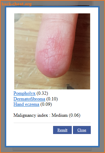 AI Dermatology - Skin Disease Diagnosis screenshot