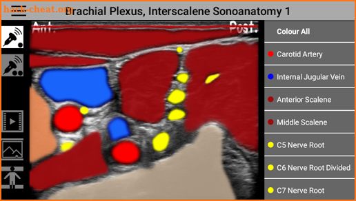 AnSo Anaesthesia Sonoanatomy screenshot