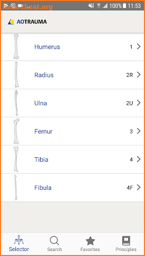 AO/OTA Fracture Classification screenshot