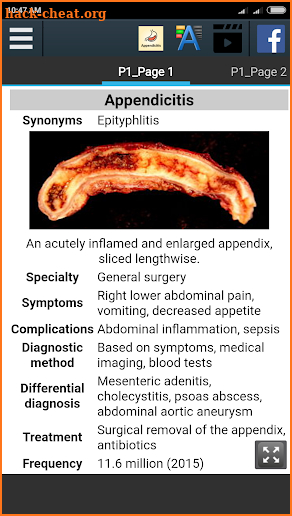 Appendicitis Info screenshot