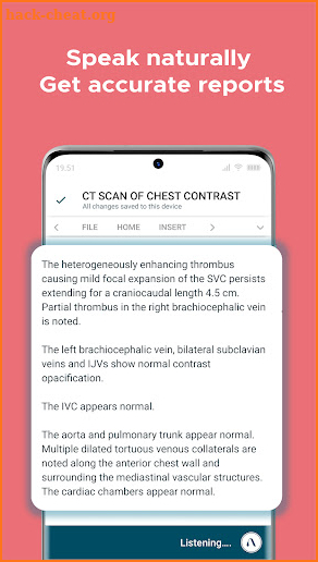 Augnito: Medical Dictation App screenshot