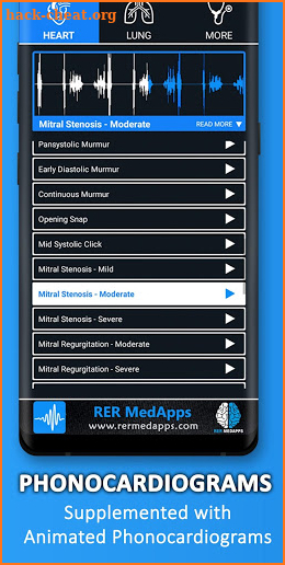 Auscultation - Heart, Lung Sounds, Cardiac Murmurs screenshot