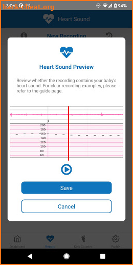 BabyDoppler screenshot