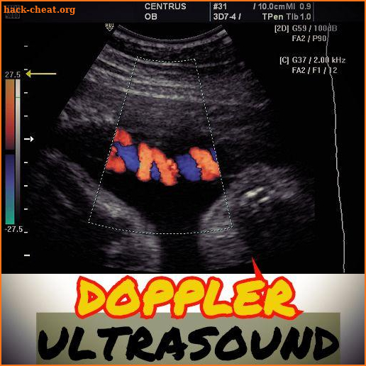 Basic Principles of Doppler Ultrasound screenshot