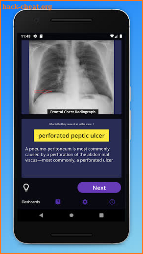 Basic Radiology for medical students screenshot