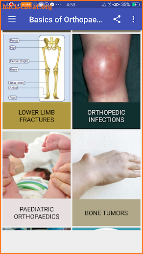 Basics of Orthopaedics screenshot