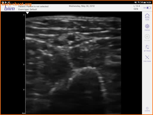 Biim Ultrasound screenshot