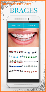 Braces Photo Editor - Braces Filter Colored screenshot