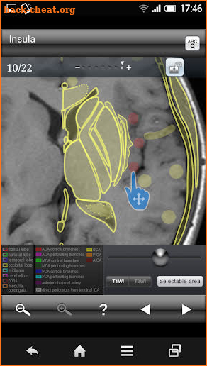 Brain MRI Sectional Wlker screenshot