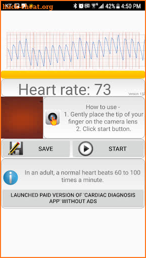 Cardiac diagnosis(formerly) Heart Rate Monitor screenshot