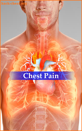 Chest Pain screenshot