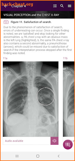 Chest X-Ray Interpretation screenshot