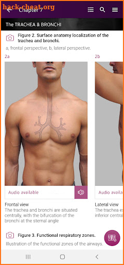 Chest X-Ray Interpretation screenshot