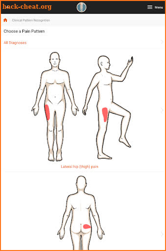 Clinical Pattern Recognition: Hip/Thigh Pain screenshot