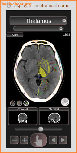 CT Passport Head/Brain / sectional anatomy / MRI screenshot