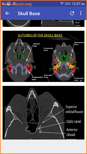 CT Scan Cross Sectional Anatomy screenshot