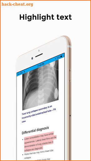 CXR FlashCards screenshot