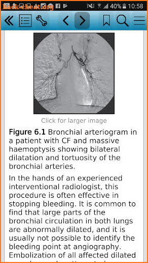 Cystic Fibrosis, Second Edition screenshot