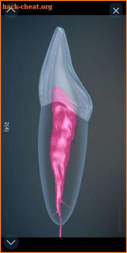 Dental 3D Illustrations for patient education screenshot