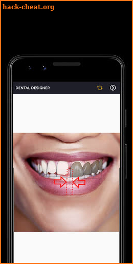 DENTAL DESIGNER screenshot