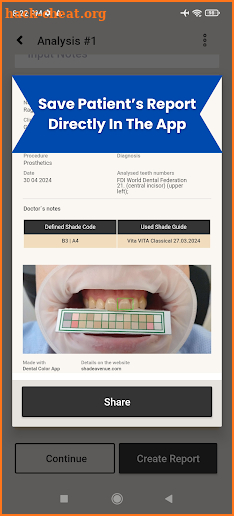 Dental Shades Avenue screenshot