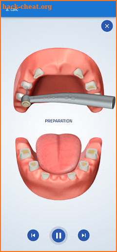 Dental Smart by DentiCalc screenshot