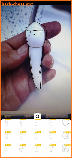 Dentamera ( Dental Anatomy ) screenshot