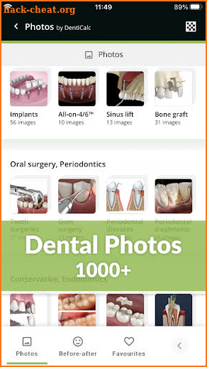 DentiCalc 4in1: Dental Care Tool for Dentists screenshot