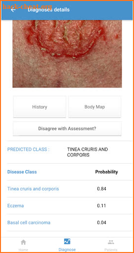 DermaAId screenshot