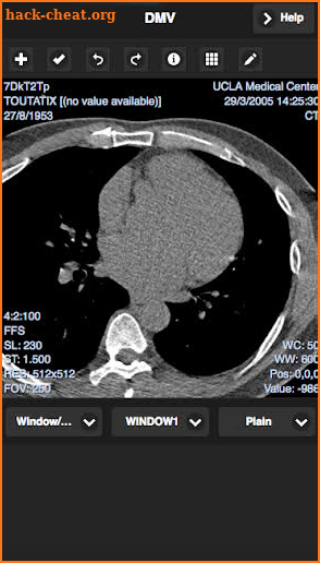 Dicom Viewer screenshot