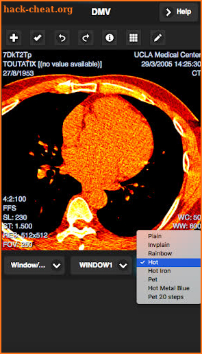 Dicom Viewer screenshot