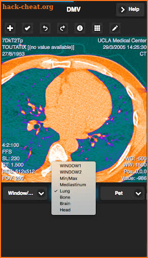 Dicom Viewer screenshot