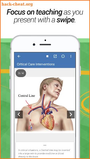 drawMD® - Free Patient Education screenshot