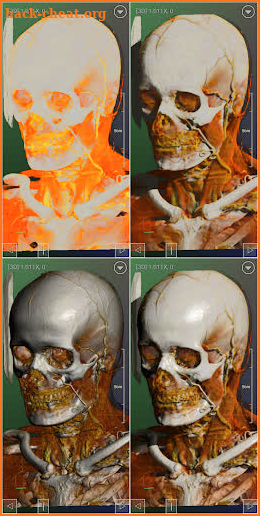 DroidRender - 3D DICOM viewer screenshot